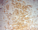 DTYMK Antibody in Immunohistochemistry (Paraffin) (IHC (P))