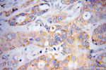 DTYMK Antibody in Immunohistochemistry (Paraffin) (IHC (P))