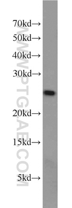 DTYMK Antibody in Western Blot (WB)