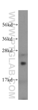 DTYMK Antibody in Western Blot (WB)