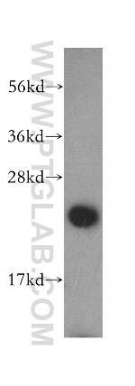 DTYMK Antibody in Western Blot (WB)