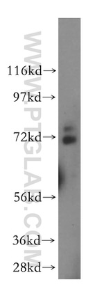 BRCC3 Antibody in Western Blot (WB)