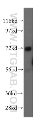 BRCC3 Antibody in Western Blot (WB)