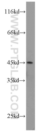 CA11 Antibody in Western Blot (WB)