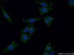 GMDS Antibody in Immunocytochemistry (ICC/IF)
