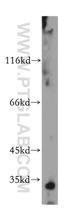 Histone H1.2 Antibody in Western Blot (WB)