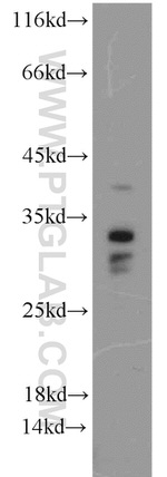 Histone H1.2 Antibody in Western Blot (WB)