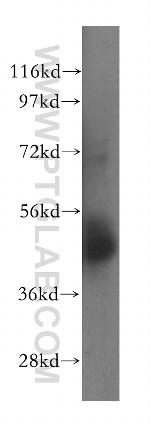 NSUN5 Antibody in Western Blot (WB)