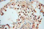 MYLIP Antibody in Immunohistochemistry (Paraffin) (IHC (P))