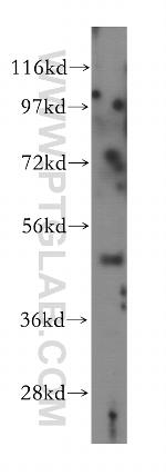 MYLIP Antibody in Western Blot (WB)