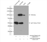 UNC45A Antibody in Immunoprecipitation (IP)