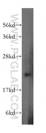 RAB31 Antibody in Western Blot (WB)