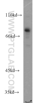 RUNX1T1 Antibody in Western Blot (WB)