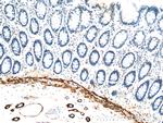 transgelin/SM22 Antibody in Immunohistochemistry (Paraffin) (IHC (P))