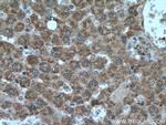 HACL1 Antibody in Immunohistochemistry (Paraffin) (IHC (P))