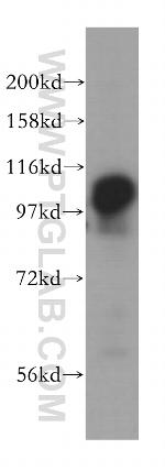 MSH2 Antibody in Western Blot (WB)