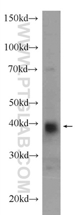 PRSS8 Antibody in Western Blot (WB)