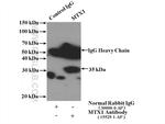 MTX1 Antibody in Immunoprecipitation (IP)