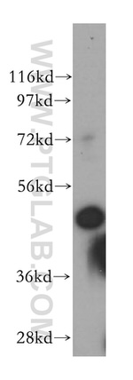 CSTF1 Antibody in Western Blot (WB)