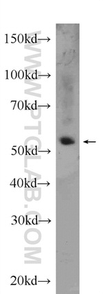 PPARA Antibody in Western Blot (WB)