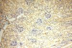 WDR5 Antibody in Immunohistochemistry (Paraffin) (IHC (P))