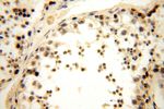 WDR5 Antibody in Immunohistochemistry (Paraffin) (IHC (P))