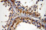 PRPS1 Antibody in Immunohistochemistry (Paraffin) (IHC (P))