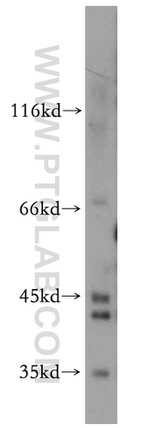 PRPS1 Antibody in Western Blot (WB)