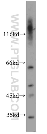 PRPS1 Antibody in Western Blot (WB)