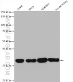 PRPS1 Antibody in Western Blot (WB)