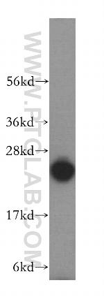 KCTD2/5/17 Antibody in Western Blot (WB)