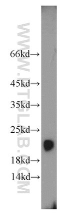 TRAPPC3 Antibody in Western Blot (WB)