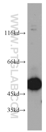 ZNF259 Antibody in Western Blot (WB)
