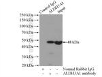 ALDH3A1 Antibody in Immunoprecipitation (IP)