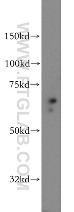 SF3A2 Antibody in Western Blot (WB)