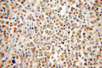 HMGB2 Antibody in Immunohistochemistry (Paraffin) (IHC (P))
