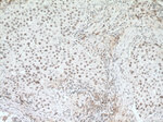 U2AF65 Antibody in Immunohistochemistry (Paraffin) (IHC (P))