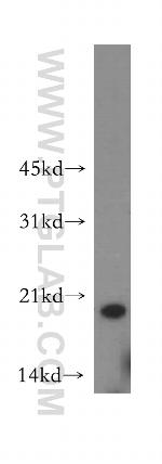 OPA3 Antibody in Western Blot (WB)