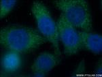 SH2D3A Antibody in Immunocytochemistry (ICC/IF)