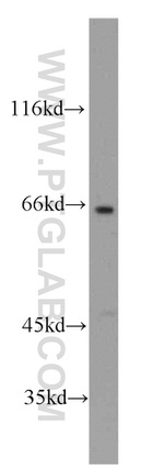 SH2D3A Antibody in Western Blot (WB)