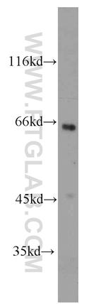 SH2D3A Antibody in Western Blot (WB)