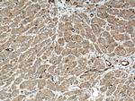 IKBKB Antibody in Immunohistochemistry (Paraffin) (IHC (P))