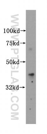 Islet 1 Antibody in Western Blot (WB)