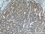 PMVK Antibody in Immunohistochemistry (Paraffin) (IHC (P))