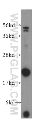 PMVK Antibody in Western Blot (WB)