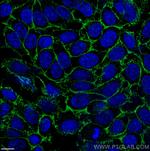 CD44 Antibody in Immunocytochemistry (ICC/IF)