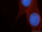 CD44 Antibody in Immunocytochemistry (ICC/IF)