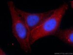 CD44 Antibody in Immunocytochemistry (ICC/IF)