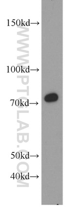 CD44 Antibody in Western Blot (WB)