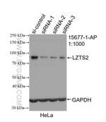 LZTS2 Antibody in Western Blot (WB)